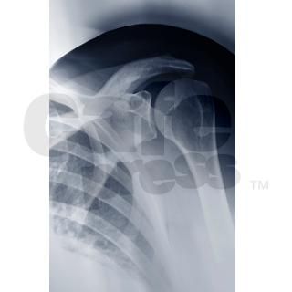 Mature womans shoulder, X ray Oval Car Magnet by ADMIN_CP_GETTY35497297